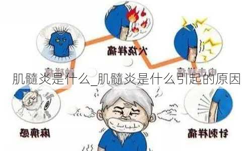 肌髓炎是什么_肌髓炎是什么引起的原因